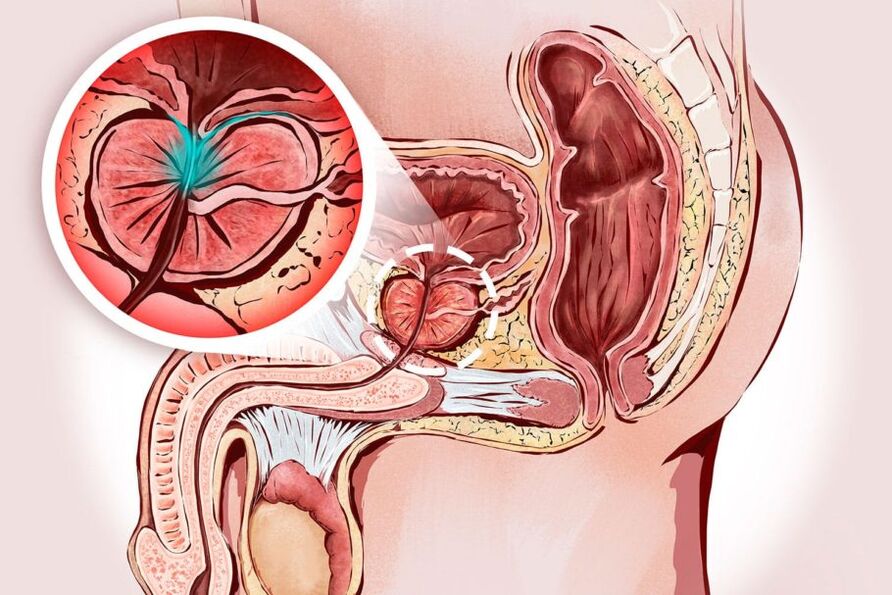 διάγνωση